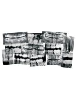 Roylco&reg; Dental X-Rays - Set of 15