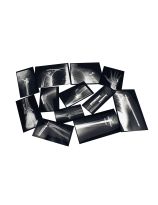 Roylco® Fixed Bone X-Rays