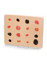 Simulateur Life/form® pour cancer de la peau - Agrandi, pâle