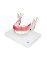 Dental Disease Model