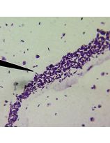 Deadly Human Diseases - Set of 10 Slides