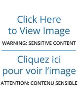 Female Breast Chart - Anatomy, Pathology and Self-Examination