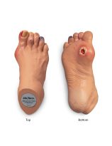 Nasco Advanced Foot Problems