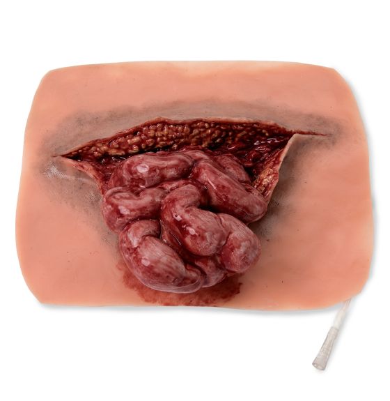 Eviscerated Intestine