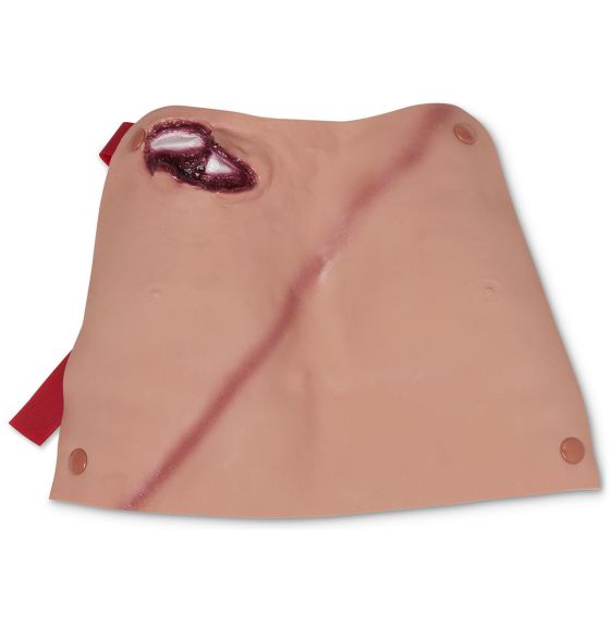 Broken Clavicle -Light