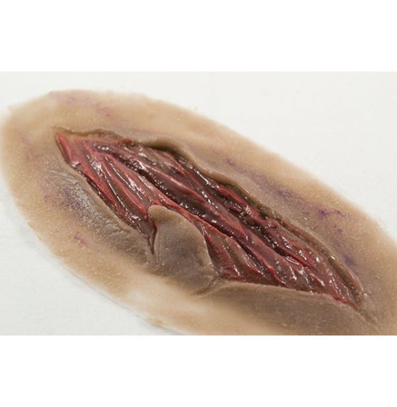 MST&trade; Basic Laceration Moulage - Dark Color - Set of 4