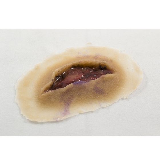 MST&trade; Basic Laceration Moulage - Medium Color - Set of 4