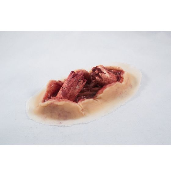 MST&trade; Dynamic (Bleeding) Compound Fracture Moulage - Manikin Colour - Set of 4