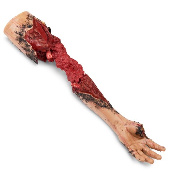 MST&trade; Partial Arm Amputation Simulator - Light Color - Left