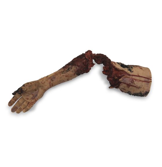 MST&trade; Partial Arm Amputation Simulator - Manikin Color - Right