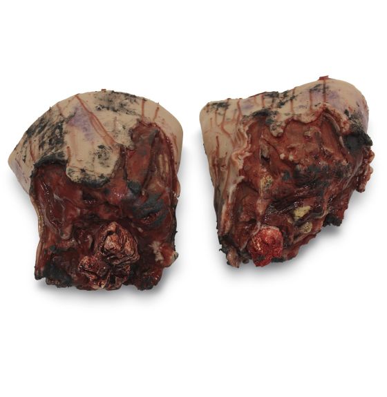 MST&trade; Full Leg Amputation Simulator - Light Color - Right