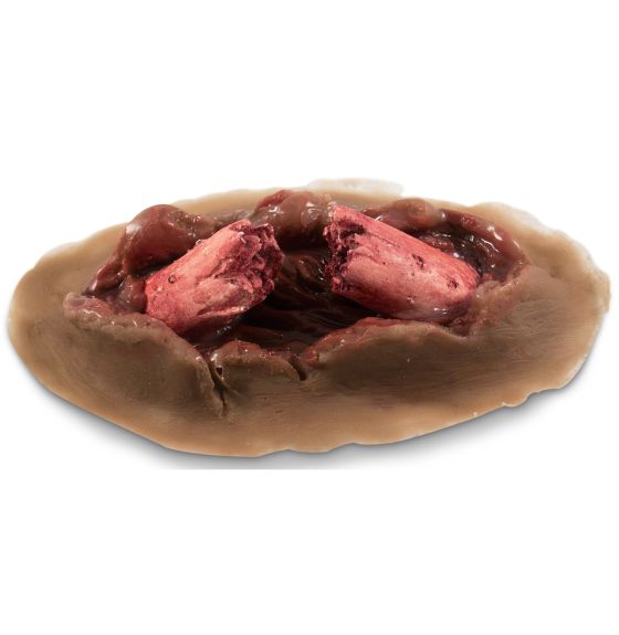 MST™ Dynamic (Bleeding) Compound Fracture Moulage - Medium Colour - Single