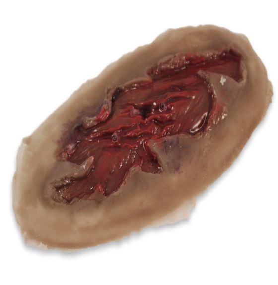 MST&trade; Non-Dynamic (Non-Bleeding) Mutilated Muscle Moulage - Light Color - Set of 4