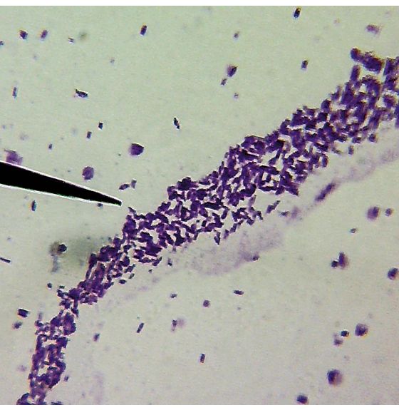 Deadly Human Diseases - Set of 10 Slides